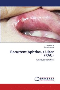 bokomslag Recurrent Aphthous Ulcer (RAU)