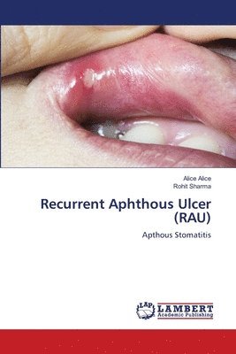 Recurrent Aphthous Ulcer (RAU) 1