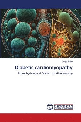 Diabetic cardiomyopathy 1