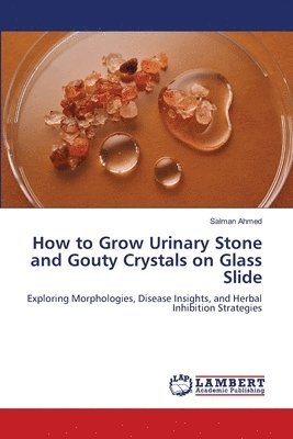 How to Grow Urinary Stone and Gouty Crystals on Glass Slide 1