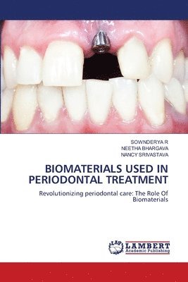 Sownderya R, Neetha Bhargava, Nancy Srivastava, SOWNDERYA R, NEETHA BHARGAVA - Biomaterials Used in Periodontal Treatment, Häftad