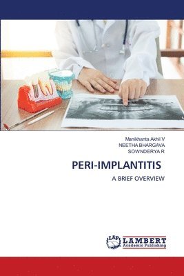 bokomslag Peri-Implantitis