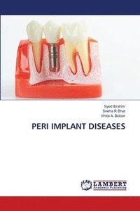 bokomslag Peri Implant Diseases
