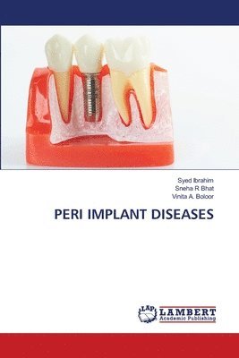 bokomslag Peri Implant Diseases