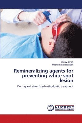 bokomslag Remineralizing agents for preventing white spot lesion