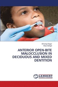 bokomslag Anterior Open-Bite Malocclusion in Deciduous and Mixed Dentition