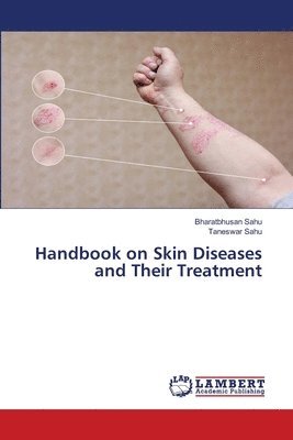 bokomslag Handbook on Skin Diseases and Their Treatment