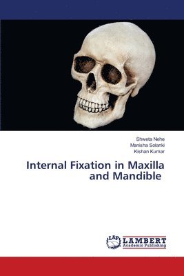 bokomslag Internal Fixation in Maxilla and Mandible