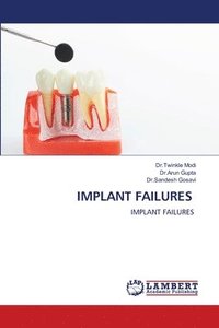 bokomslag Implant Failures