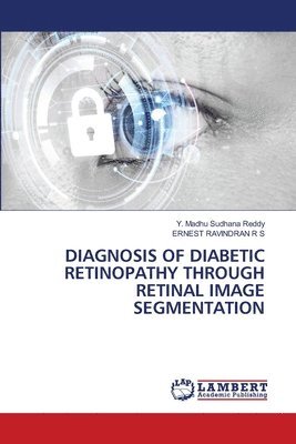 bokomslag Diagnosis of Diabetic Retinopathy Through Retinal Image Segmentation