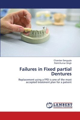 bokomslag Failures in Fixed partial Dentures