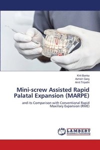 bokomslag Mini-screw Assisted Rapid Palatal Expansion (MARPE)
