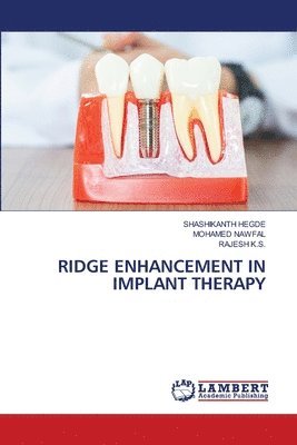 bokomslag Ridge Enhancement in Implant Therapy