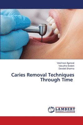 Caries Removal Techniques Through Time 1