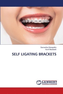 bokomslag Self Ligating Brackets