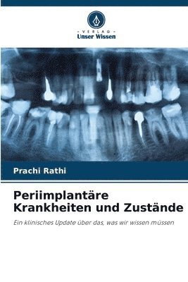 bokomslag Periimplantre Krankheiten und Zustnde