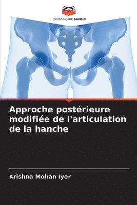 Approche postrieure modifie de l'articulation de la hanche 1