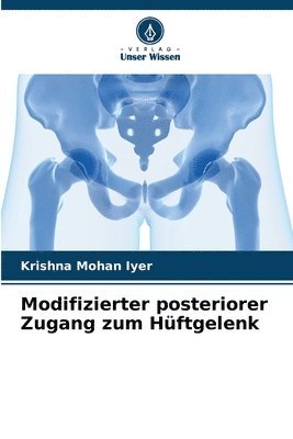 bokomslag Modifizierter posteriorer Zugang zum Hftgelenk