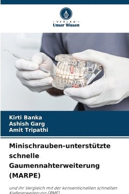 bokomslag Minischrauben-untersttzte schnelle Gaumennahterweiterung (MARPE)