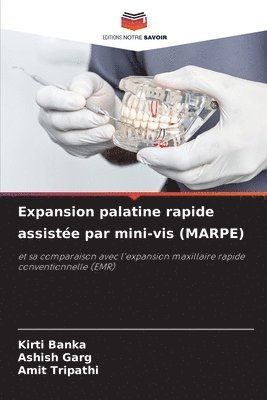 bokomslag Expansion palatine rapide assiste par mini-vis (MARPE)