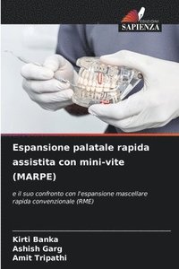 bokomslag Espansione palatale rapida assistita con mini-vite (MARPE)