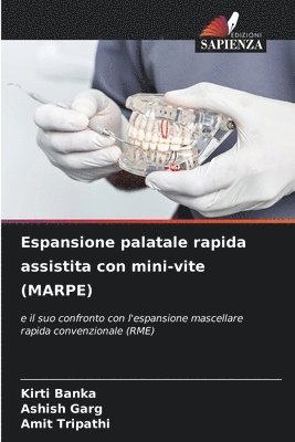 Kirti Banka, Ashish Garg, Amit Tripathi - Espansione palatale rapida assistita con mini-vite (MARPE), Häftad
