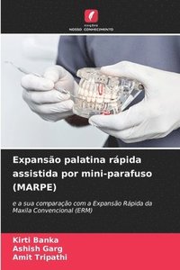 bokomslag Expanso palatina rpida assistida por mini-parafuso (MARPE)