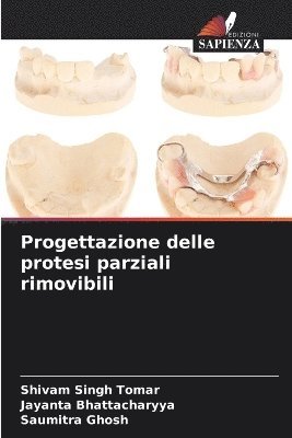 bokomslag Progettazione delle protesi parziali rimovibili