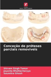 bokomslag Conceo de prteses parciais removveis