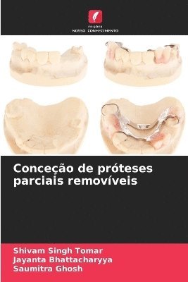 bokomslag Conceo de prteses parciais removveis