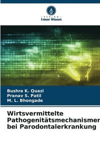 bokomslag Wirtsvermittelte Pathogenittsmechanismen bei Parodontalerkrankung