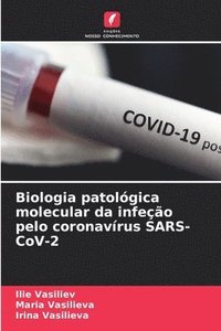 bokomslag Biologia patolgica molecular da infeo pelo coronavrus SARS-CoV-2