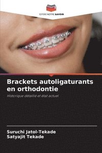 bokomslag Brackets autoligaturants en orthodontie
