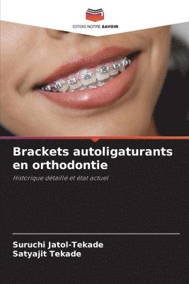 Brackets autoligaturants en orthodontie 1