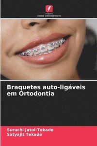 bokomslag Braquetes auto-ligveis em Ortodontia