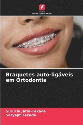 Braquetes auto-ligveis em Ortodontia 1