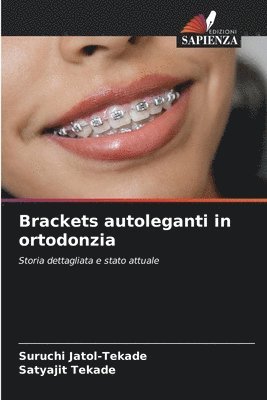 bokomslag Brackets autoleganti in ortodonzia