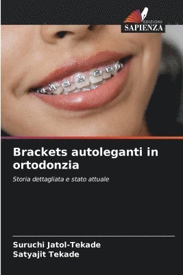 Brackets autoleganti in ortodonzia 1