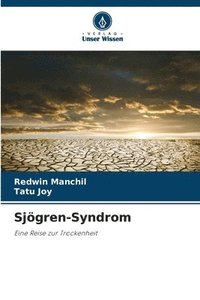 bokomslag Sjögren-Syndrom