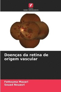 bokomslag Doenas da retina de origem vascular
