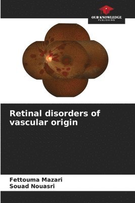 Retinal disorders of vascular origin 1