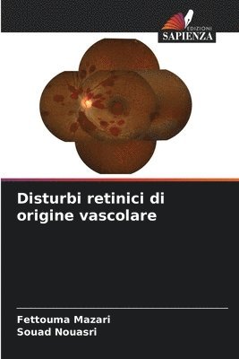 bokomslag Disturbi retinici di origine vascolare