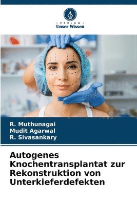 bokomslag Autogenes Knochentransplantat zur Rekonstruktion von Unterkieferdefekten