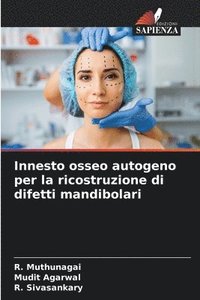 bokomslag Innesto osseo autogeno per la ricostruzione di difetti mandibolari