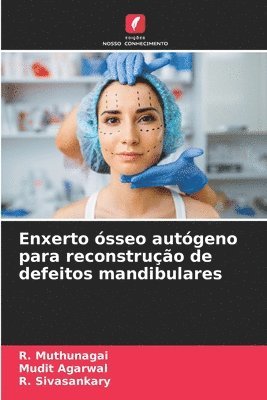 bokomslag Enxerto sseo autgeno para reconstruo de defeitos mandibulares