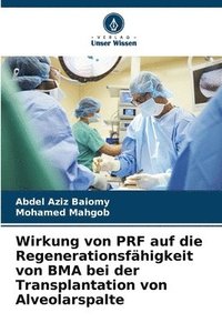 bokomslag Wirkung von PRF auf die Regenerationsfähigkeit von BMA bei der Transplantation von Alveolarspalte