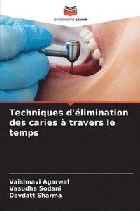 bokomslag Techniques d'limination des caries  travers le temps