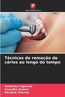 Tcnicas de remoo de cries ao longo do tempo 1