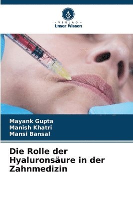 Die Rolle der Hyaluronsure in der Zahnmedizin 1