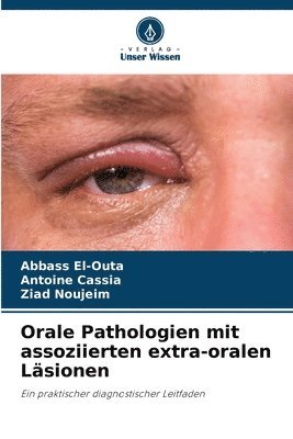 Orale Pathologien mit assoziierten extra-oralen Lsionen 1